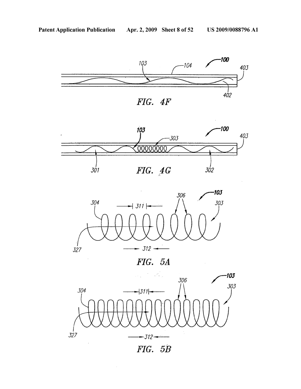 Systems and Methods for Treating Septal Defects - diagram, schematic, and image 09