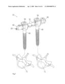 Spinal fixation device having a flexible cable and jointed components received thereon diagram and image