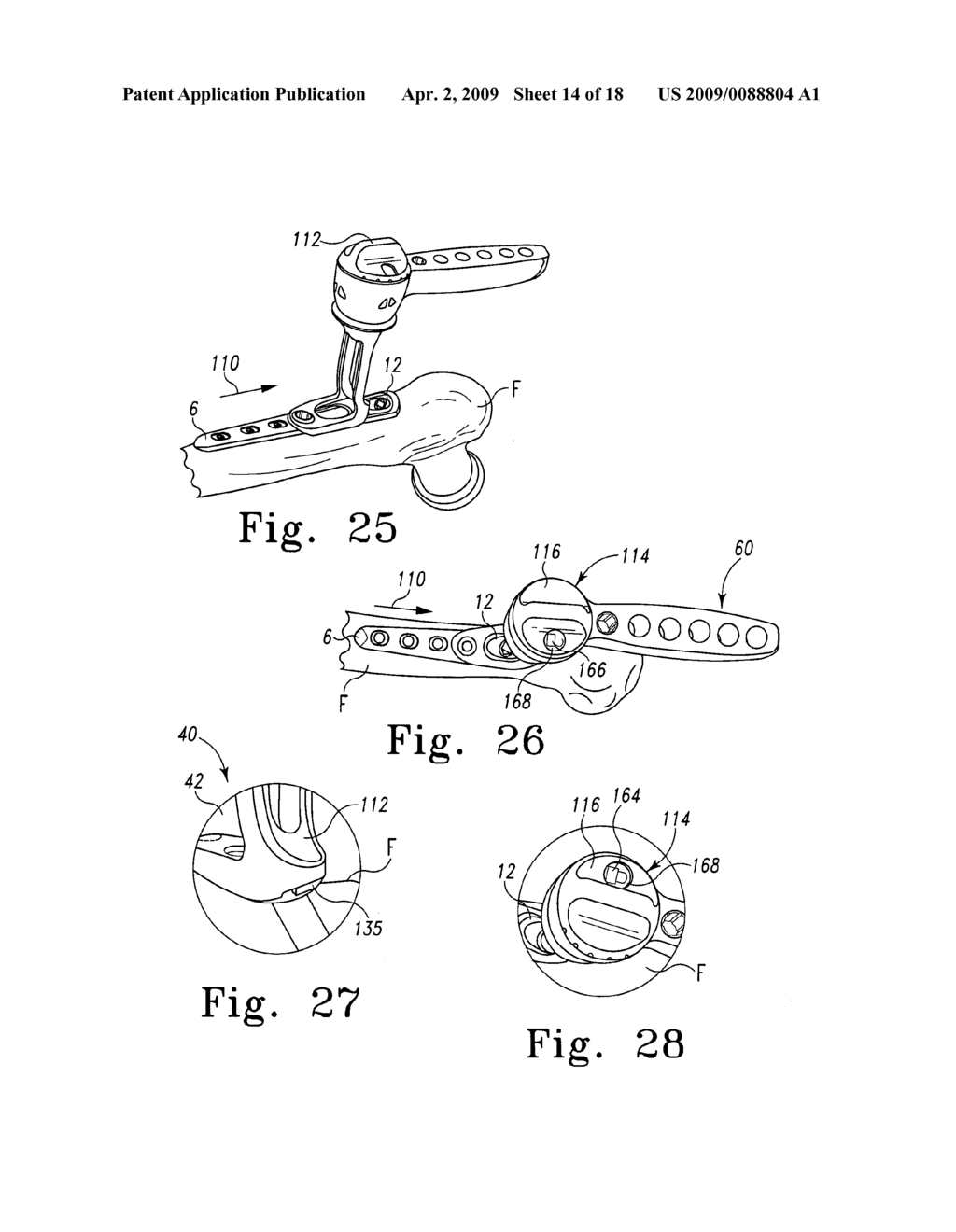 Plate holder assembly having movable guide component - diagram, schematic, and image 15