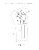 Plate holder assembly having bone plate seating confirmation arrangement diagram and image