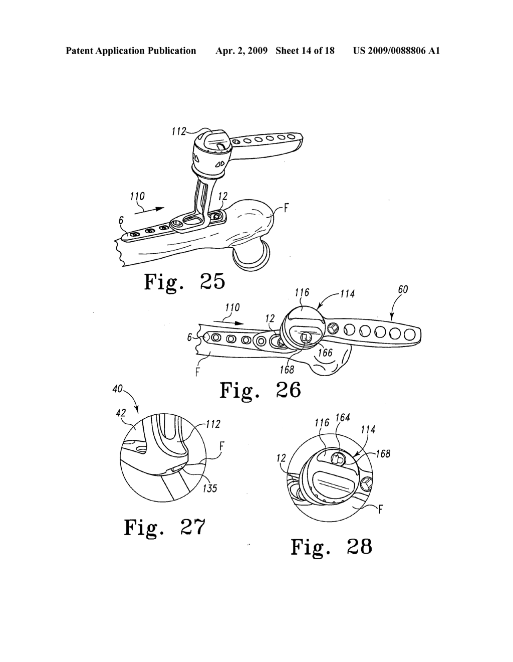 Plate holder assembly having bone plate seating confirmation arrangement - diagram, schematic, and image 15