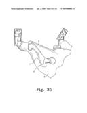 Plate holder assembly having bone plate seating confirmation arrangement diagram and image