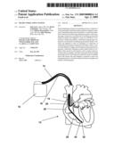 HEART STIMULATING SYSTEM diagram and image