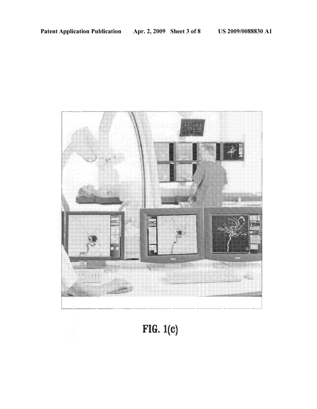 SYSTEM AND METHOD FOR INTRAOPERATIVE GUIDANCE OF STENT PLACEMENT DURING ENDOVASCULAR INTERVENTIONS - diagram, schematic, and image 04