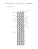 STENT AND STENT DELIVERY DEVICE diagram and image