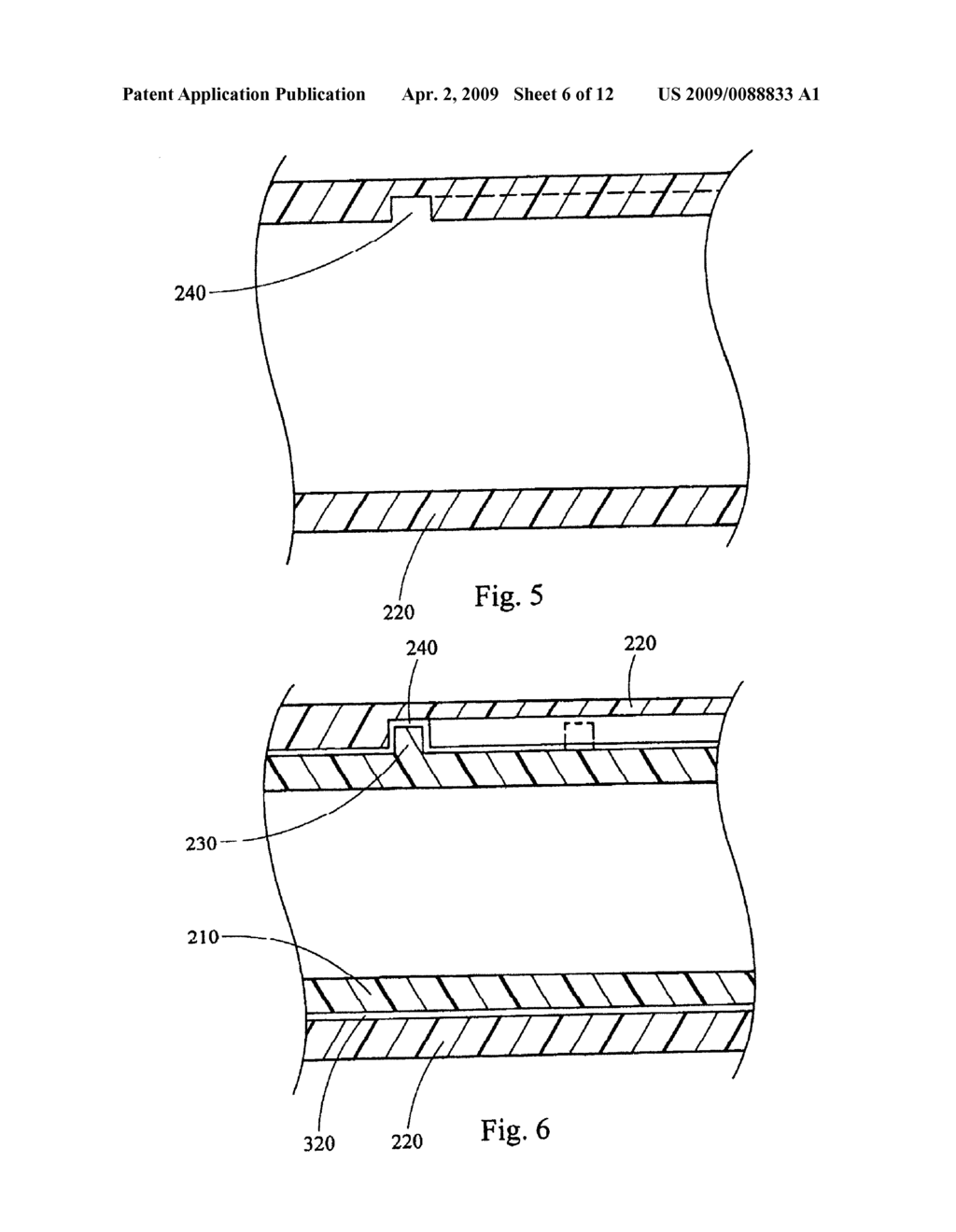 DOUBLE WALL STENT WITH RETRIEVAL MEMBER - diagram, schematic, and image 07