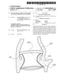 TRANSLUMENALLY IMPLANTABLE HEART VALVE WITH FORMED IN PLACE SUPPORT diagram and image