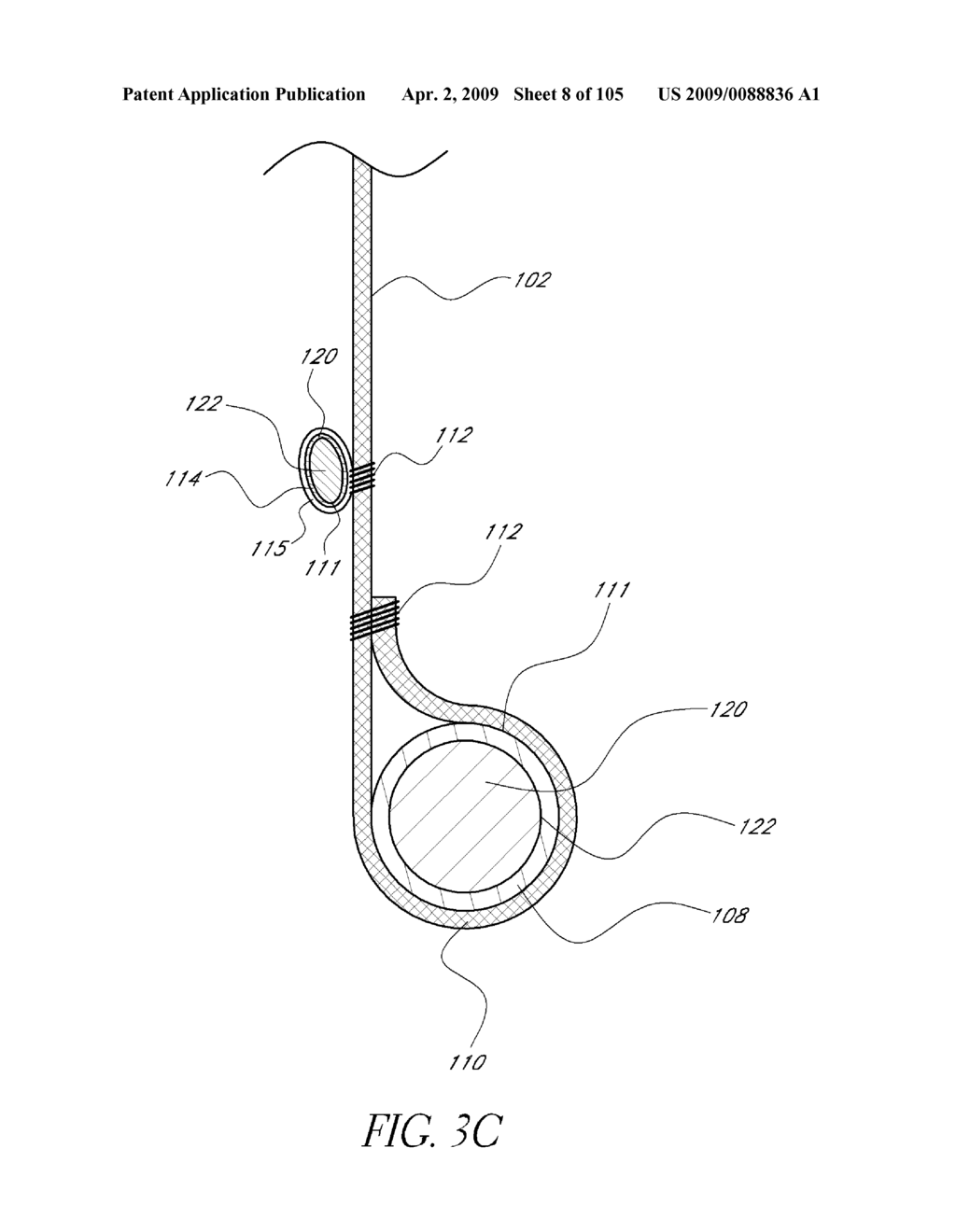 TRANSLUMENALLY IMPLANTABLE HEART VALVE WITH FORMED IN PLACE SUPPORT - diagram, schematic, and image 09