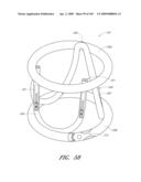 TRANSLUMENALLY IMPLANTABLE HEART VALVE WITH FORMED IN PLACE SUPPORT diagram and image