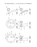 TRANSLUMENALLY IMPLANTABLE HEART VALVE WITH FORMED IN PLACE SUPPORT diagram and image