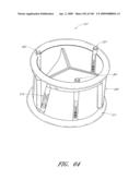 TRANSLUMENALLY IMPLANTABLE HEART VALVE WITH FORMED IN PLACE SUPPORT diagram and image