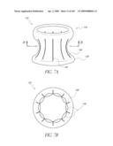 TRANSLUMENALLY IMPLANTABLE HEART VALVE WITH FORMED IN PLACE SUPPORT diagram and image