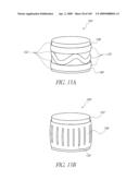 TRANSLUMENALLY IMPLANTABLE HEART VALVE WITH FORMED IN PLACE SUPPORT diagram and image