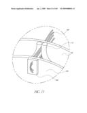 TRANSLUMENALLY IMPLANTABLE HEART VALVE WITH FORMED IN PLACE SUPPORT diagram and image