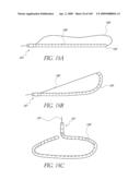 TRANSLUMENALLY IMPLANTABLE HEART VALVE WITH FORMED IN PLACE SUPPORT diagram and image