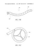 TRANSLUMENALLY IMPLANTABLE HEART VALVE WITH FORMED IN PLACE SUPPORT diagram and image