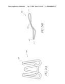 TRANSLUMENALLY IMPLANTABLE HEART VALVE WITH FORMED IN PLACE SUPPORT diagram and image