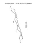 TRANSLUMENALLY IMPLANTABLE HEART VALVE WITH FORMED IN PLACE SUPPORT diagram and image