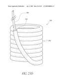 TRANSLUMENALLY IMPLANTABLE HEART VALVE WITH FORMED IN PLACE SUPPORT diagram and image