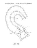 TRANSLUMENALLY IMPLANTABLE HEART VALVE WITH FORMED IN PLACE SUPPORT diagram and image