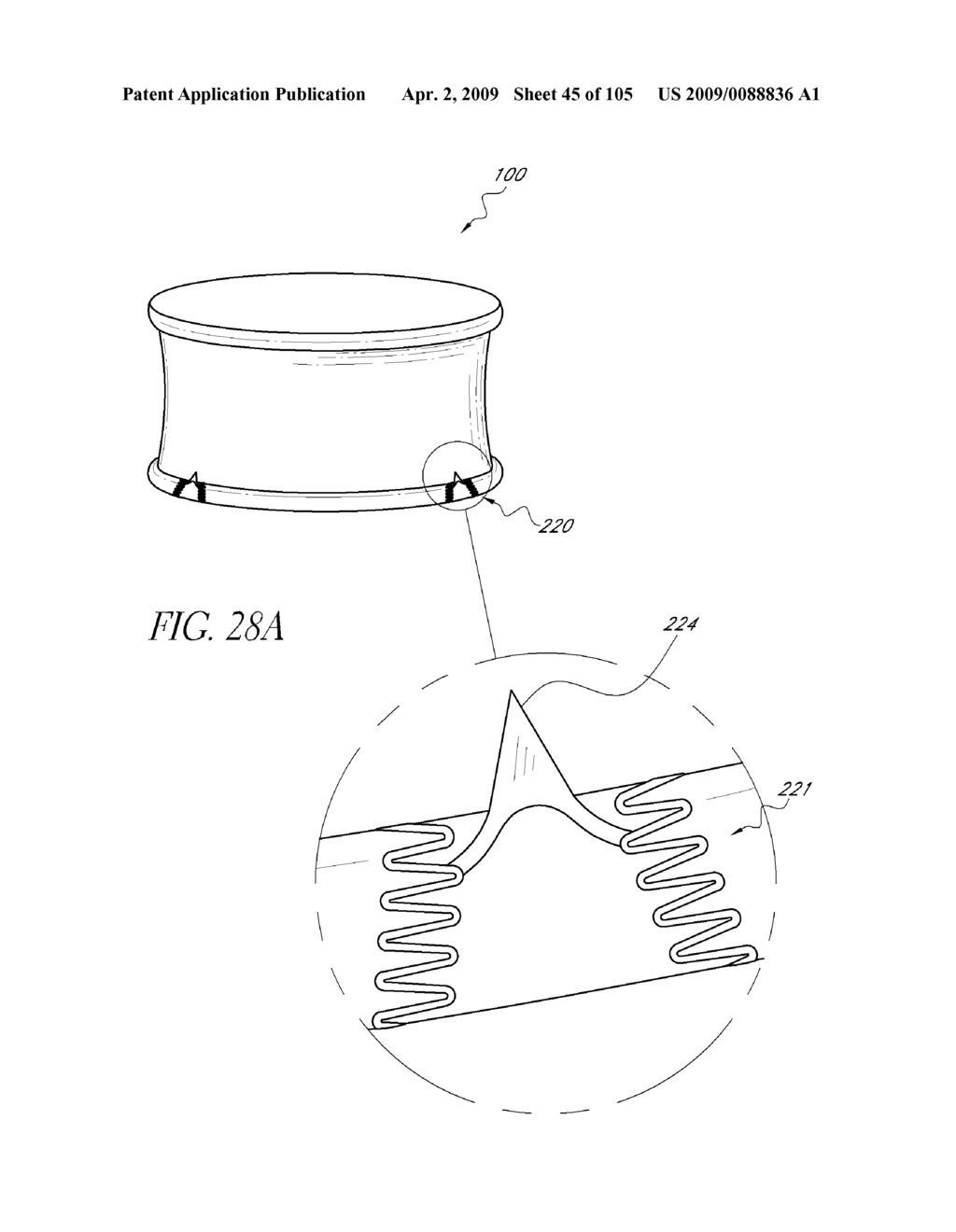 TRANSLUMENALLY IMPLANTABLE HEART VALVE WITH FORMED IN PLACE SUPPORT - diagram, schematic, and image 46