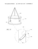 TRANSLUMENALLY IMPLANTABLE HEART VALVE WITH FORMED IN PLACE SUPPORT diagram and image