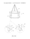 TRANSLUMENALLY IMPLANTABLE HEART VALVE WITH FORMED IN PLACE SUPPORT diagram and image