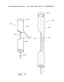 TRANSLUMENALLY IMPLANTABLE HEART VALVE WITH FORMED IN PLACE SUPPORT diagram and image