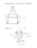 TRANSLUMENALLY IMPLANTABLE HEART VALVE WITH FORMED IN PLACE SUPPORT diagram and image