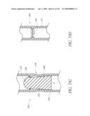 TRANSLUMENALLY IMPLANTABLE HEART VALVE WITH FORMED IN PLACE SUPPORT diagram and image