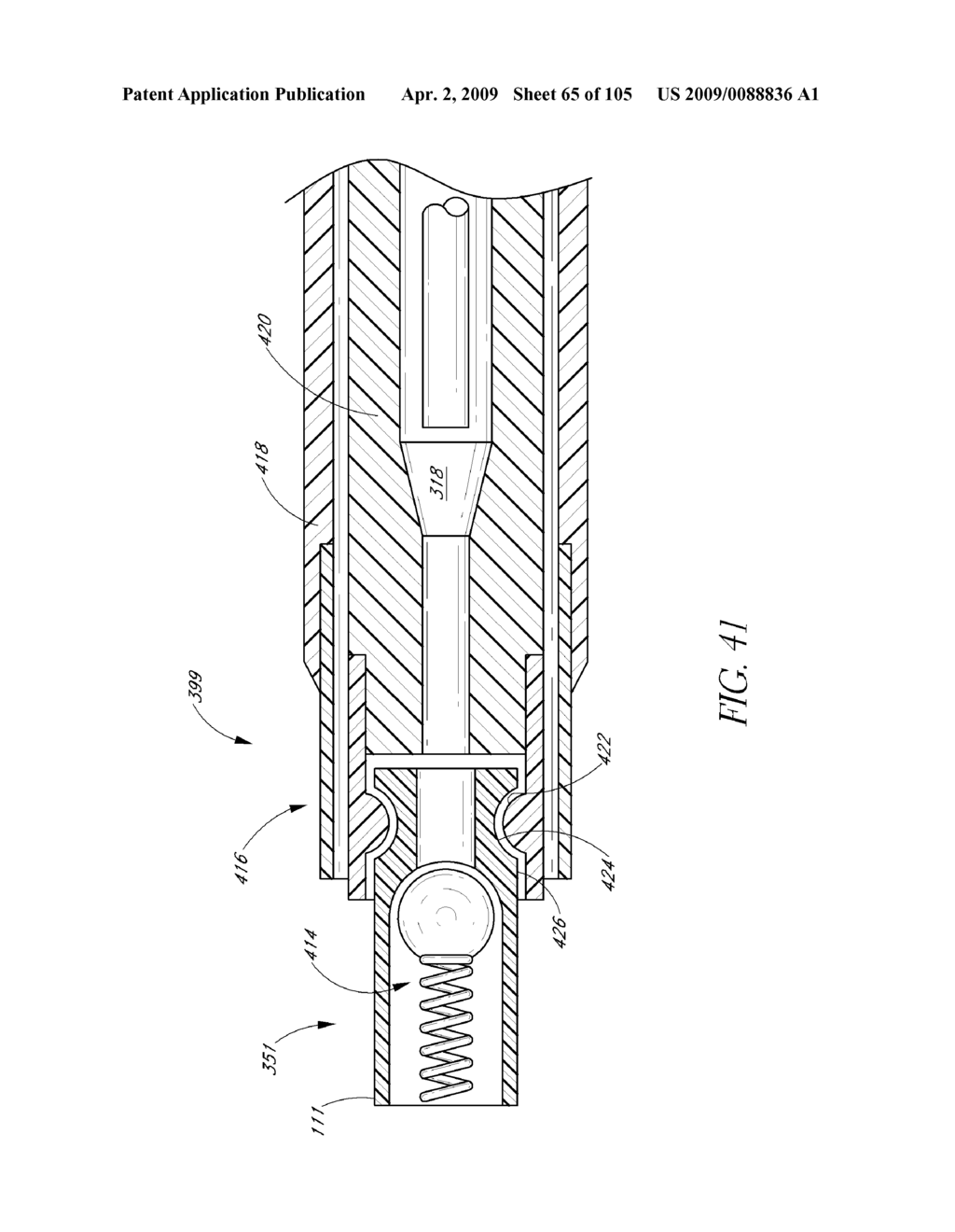 TRANSLUMENALLY IMPLANTABLE HEART VALVE WITH FORMED IN PLACE SUPPORT - diagram, schematic, and image 66