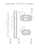 TRANSLUMENALLY IMPLANTABLE HEART VALVE WITH FORMED IN PLACE SUPPORT diagram and image