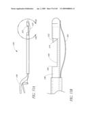 TRANSLUMENALLY IMPLANTABLE HEART VALVE WITH FORMED IN PLACE SUPPORT diagram and image