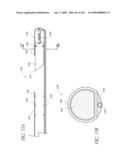 TRANSLUMENALLY IMPLANTABLE HEART VALVE WITH FORMED IN PLACE SUPPORT diagram and image