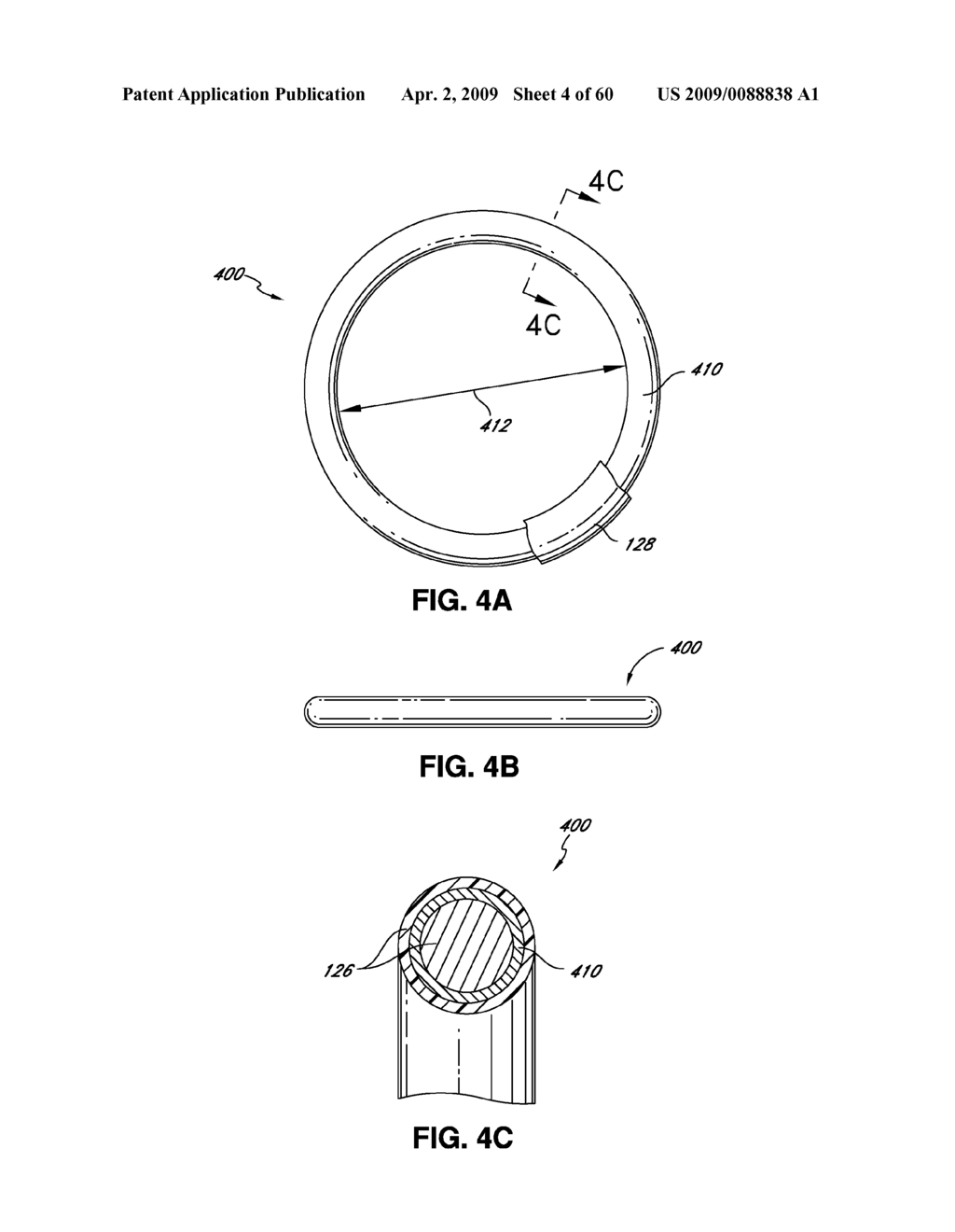 ADJUSTABLE ANNULOPLASTY RING AND ACTIVATION SYSTEM - diagram, schematic, and image 05