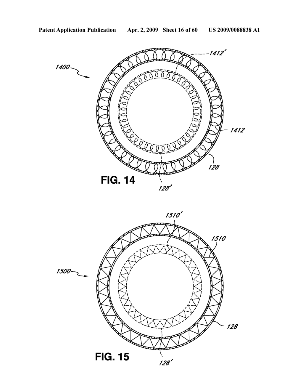 ADJUSTABLE ANNULOPLASTY RING AND ACTIVATION SYSTEM - diagram, schematic, and image 17