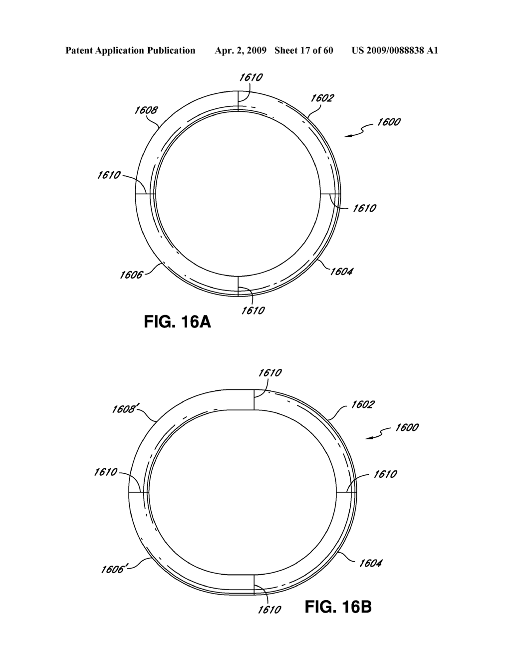 ADJUSTABLE ANNULOPLASTY RING AND ACTIVATION SYSTEM - diagram, schematic, and image 18