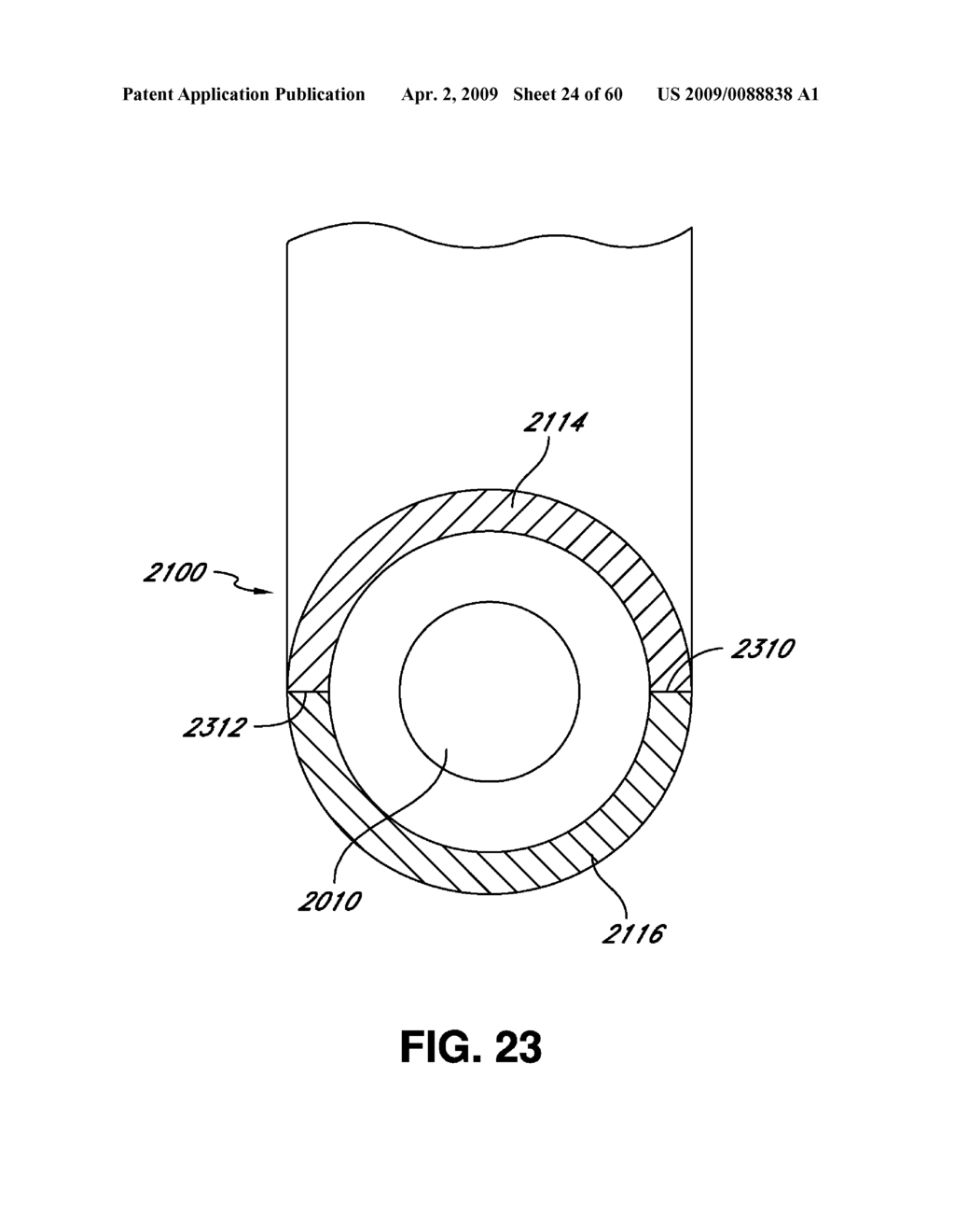 ADJUSTABLE ANNULOPLASTY RING AND ACTIVATION SYSTEM - diagram, schematic, and image 25