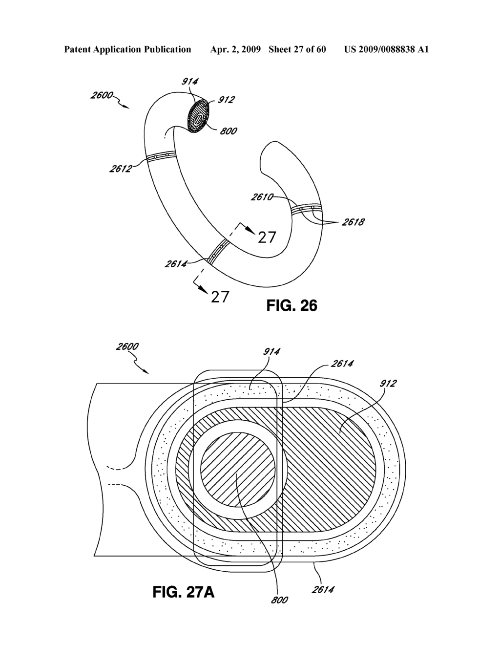 ADJUSTABLE ANNULOPLASTY RING AND ACTIVATION SYSTEM - diagram, schematic, and image 28