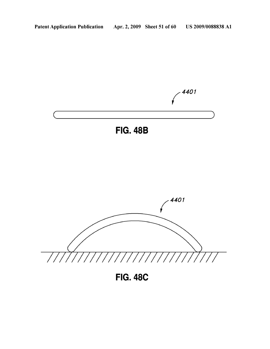 ADJUSTABLE ANNULOPLASTY RING AND ACTIVATION SYSTEM - diagram, schematic, and image 52