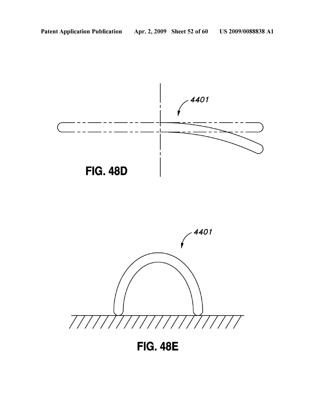 ADJUSTABLE ANNULOPLASTY RING AND ACTIVATION SYSTEM - diagram, schematic, and image 53