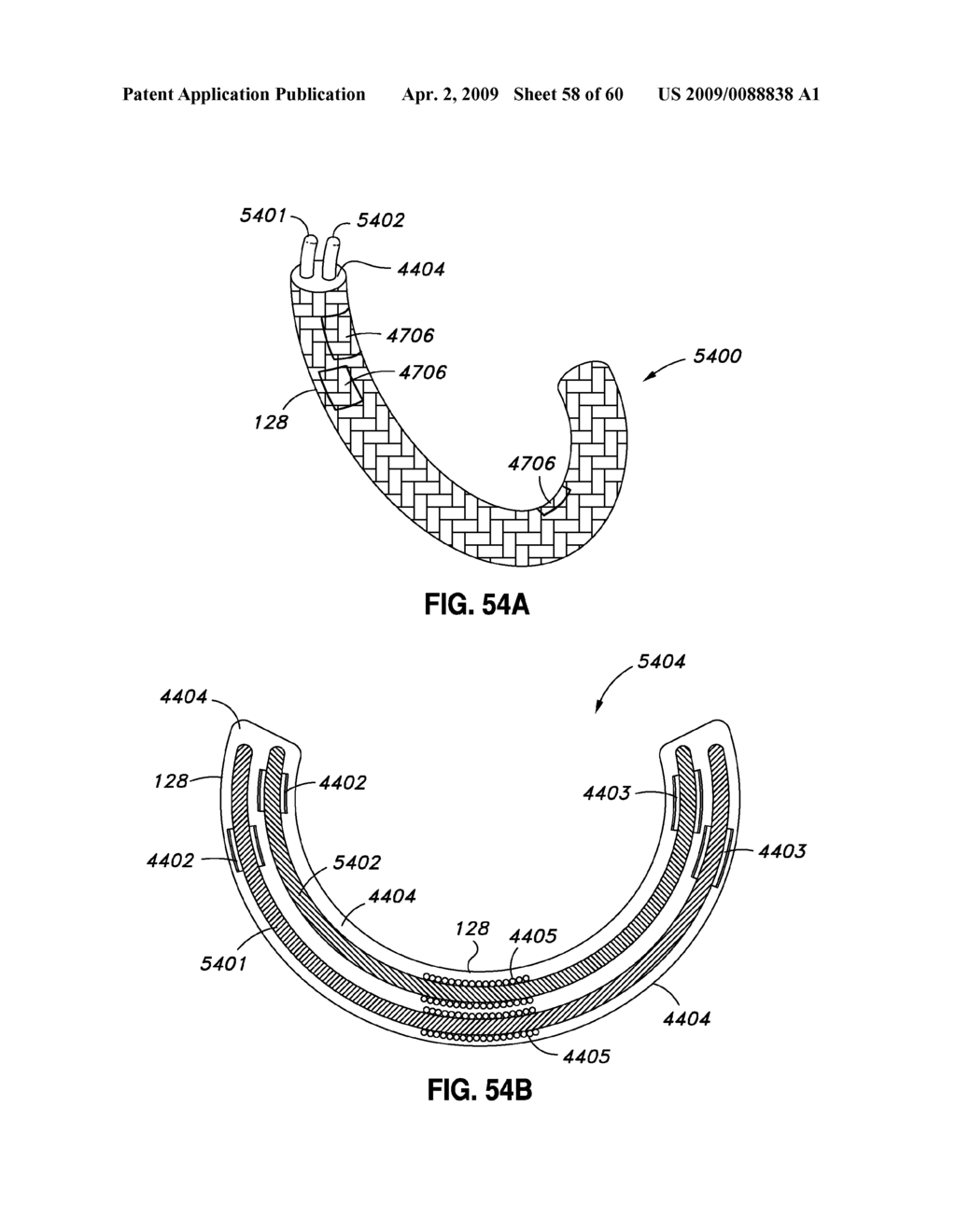 ADJUSTABLE ANNULOPLASTY RING AND ACTIVATION SYSTEM - diagram, schematic, and image 59