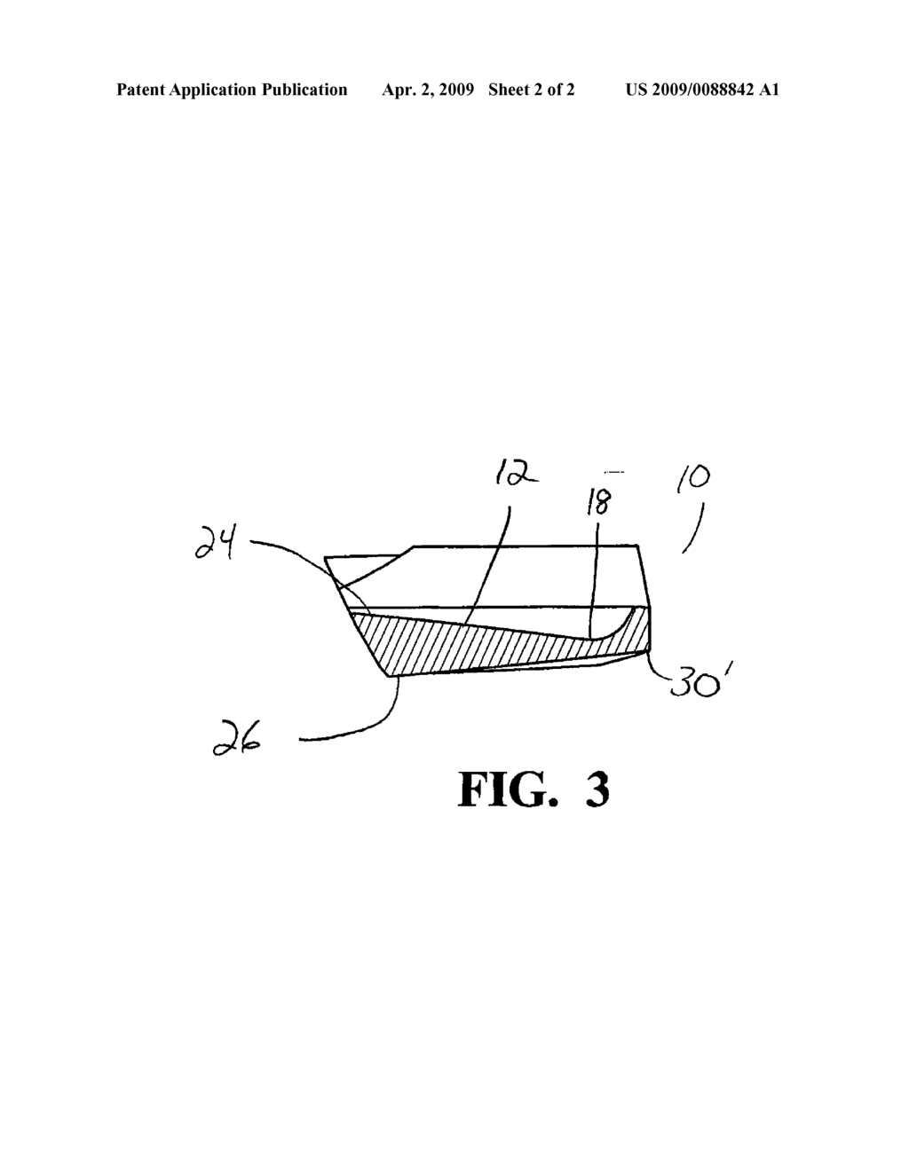 Intraocular Lens - diagram, schematic, and image 03