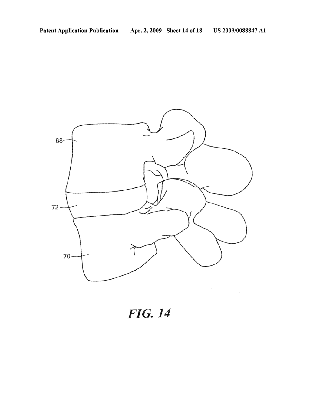 SURGICAL INSTRUMENT SYSTEM - diagram, schematic, and image 15