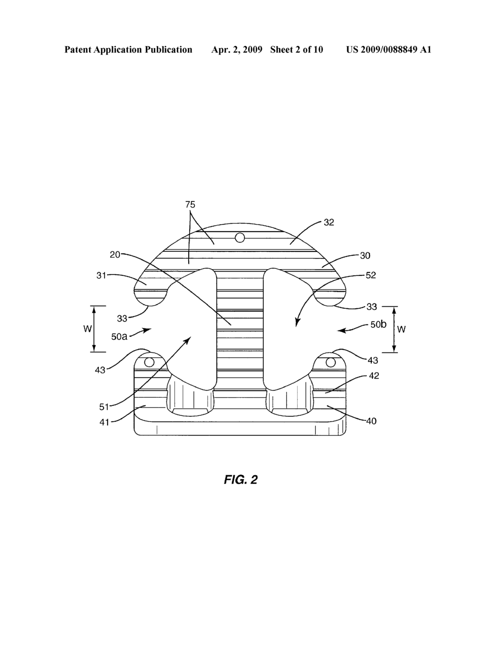 Intervertebral Implant - diagram, schematic, and image 03