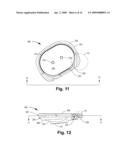 ORTHOPEDIC DEVICE ASSEMBLY WITH ELEMENTS COUPLED BY A RETAINING STRUCTURE diagram and image