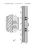 PRESSURE DISPERSION SUPPORT SYSTEMS diagram and image