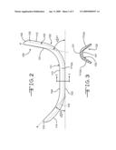 Guide device for tracheal intubation diagram and image