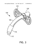 BALLOON CUFF TRACHEOSTOMY TUBE diagram and image