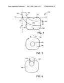 BALLOON CUFF TRACHEOSTOMY TUBE diagram and image